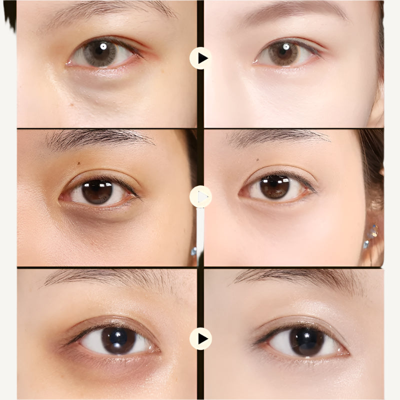 Verza 24K Renewal Eye Masks – Gold Collagen Infusion (30 Pairs)